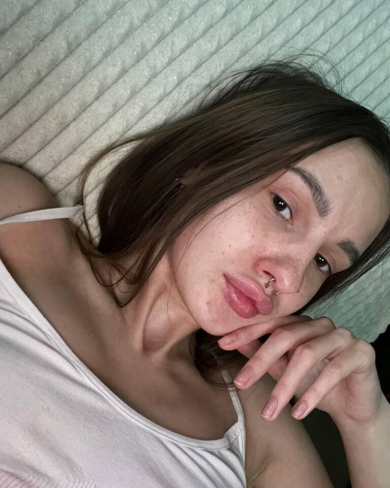 keta_losers